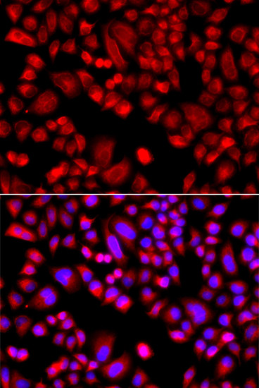 p21 ARC Antibody in Immunocytochemistry (ICC/IF)