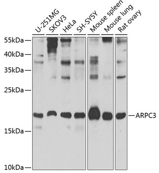 p21 ARC Antibody in Western Blot (WB)