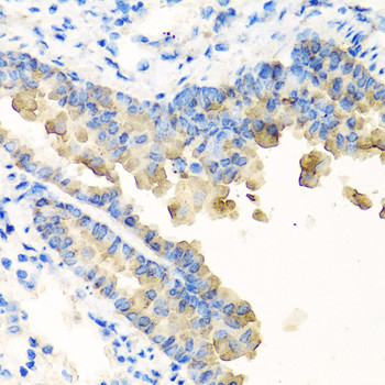 NYX Antibody in Immunohistochemistry (Paraffin) (IHC (P))