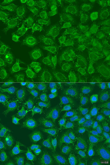 eIF2b alpha Antibody in Immunocytochemistry (ICC/IF)