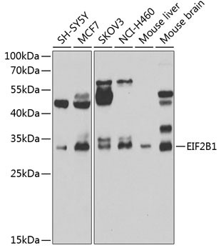 eIF2b alpha Antibody in Western Blot (WB)