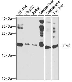 LIM2 Antibody in Western Blot (WB)