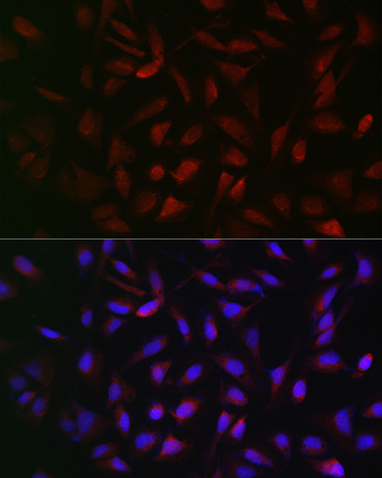 PFKP Antibody in Immunocytochemistry (ICC/IF)