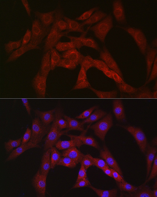 PFKP Antibody in Immunocytochemistry (ICC/IF)