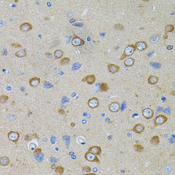 PFKP Antibody in Immunohistochemistry (Paraffin) (IHC (P))