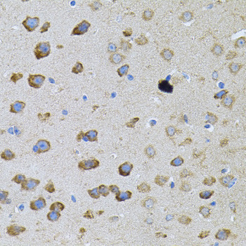 PFKP Antibody in Immunohistochemistry (Paraffin) (IHC (P))