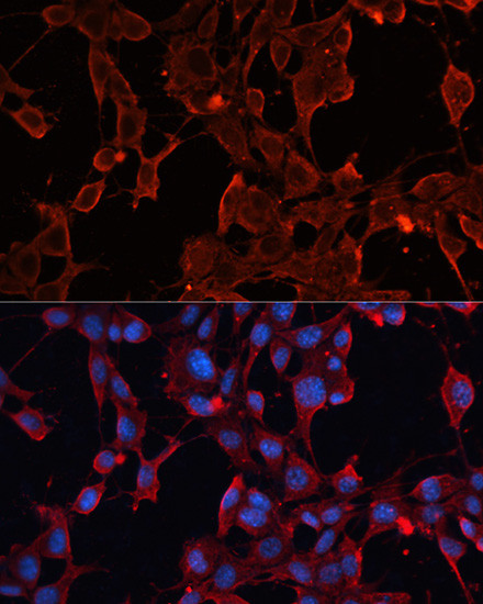 ADAM12 Antibody in Immunocytochemistry (ICC/IF)