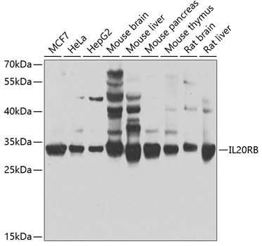 IL20RB Antibody in Western Blot (WB)