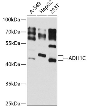 Alcohol Dehydrogenase 1C Antibody in Western Blot (WB)