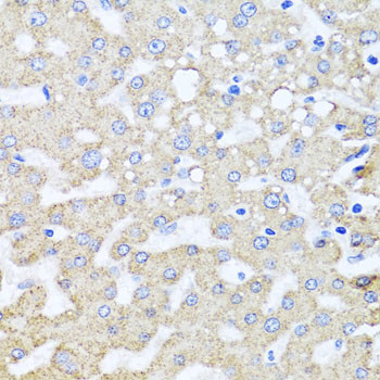 ARL6 Antibody in Immunohistochemistry (Paraffin) (IHC (P))