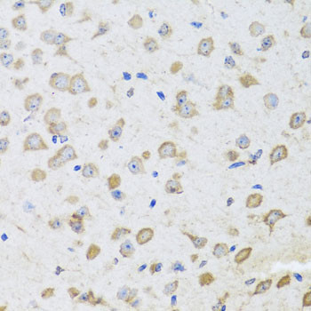 ARL6 Antibody in Immunohistochemistry (Paraffin) (IHC (P))