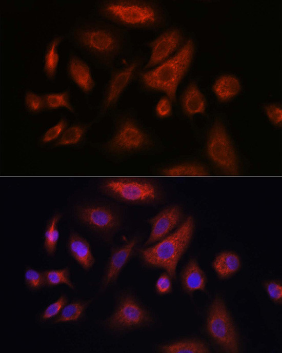 RSPO1 Antibody in Immunocytochemistry (ICC/IF)