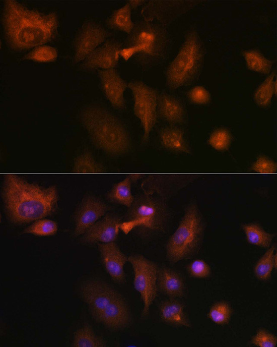 RSPO1 Antibody in Immunocytochemistry (ICC/IF)