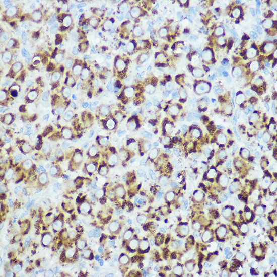 RSPO1 Antibody in Immunohistochemistry (Paraffin) (IHC (P))