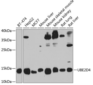 UBE2D4 Antibody in Western Blot (WB)