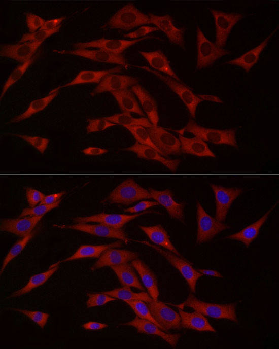 cGAS Antibody in Immunocytochemistry (ICC/IF)