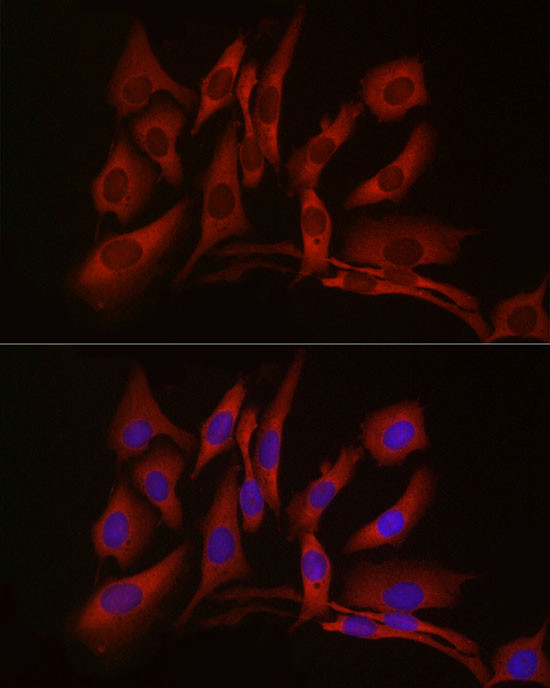 cGAS Antibody in Immunocytochemistry (ICC/IF)