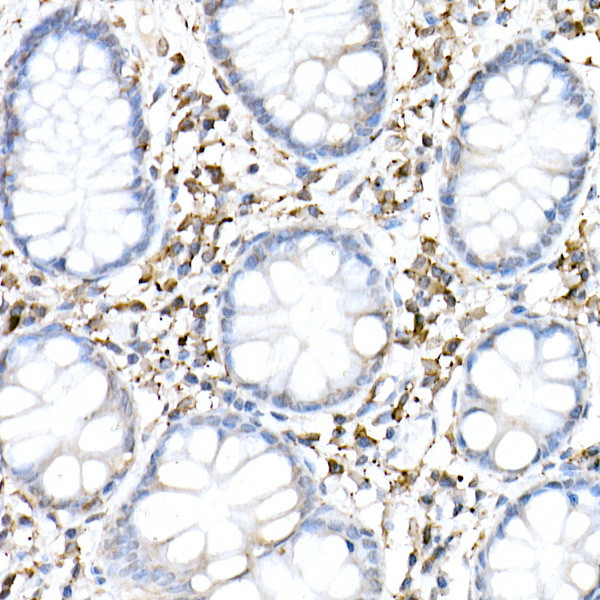 cGAS Antibody in Immunohistochemistry (Paraffin) (IHC (P))