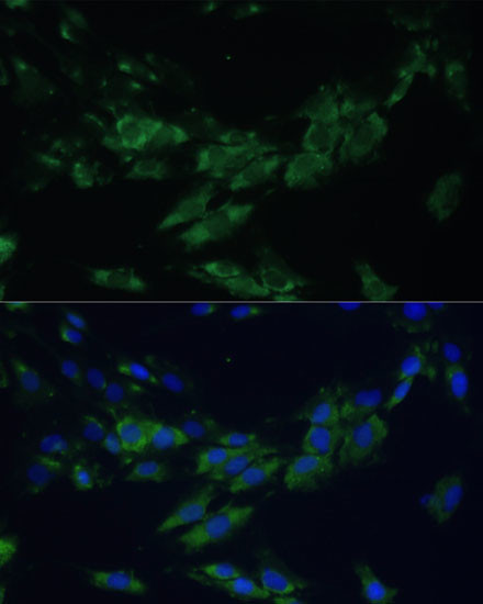 EphA4 Antibody in Immunocytochemistry (ICC/IF)