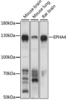 EphA4 Antibody in Western Blot (WB)