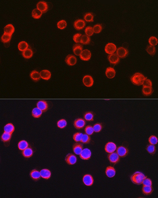 CFTR Antibody in Immunocytochemistry (ICC/IF)