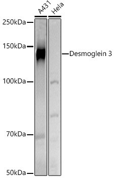 Desmoglein 3 Antibody in Western Blot (WB)