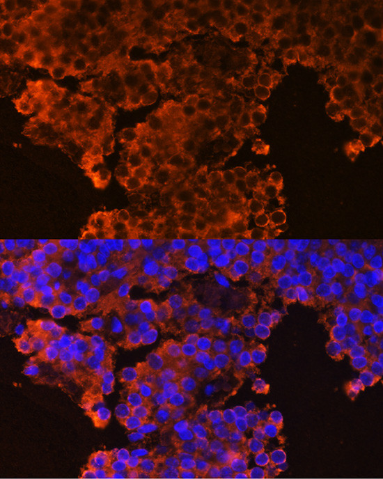 GHRHR Antibody in Immunocytochemistry (ICC/IF)