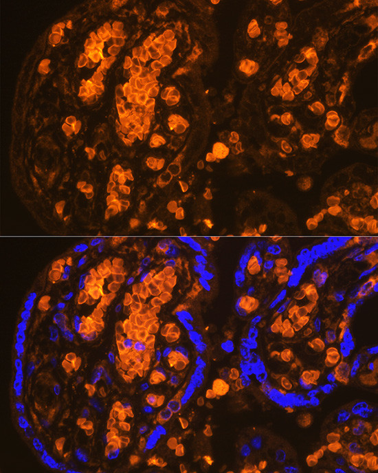 HBA2 Antibody in Immunohistochemistry (Paraffin) (IHC (P))