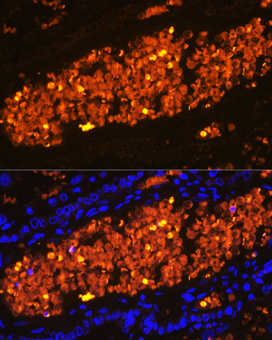 HBA2 Antibody in Immunohistochemistry (Paraffin) (IHC (P))