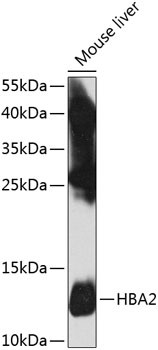 HBA2 Antibody in Western Blot (WB)