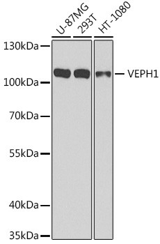 VEPH1 Antibody in Western Blot (WB)