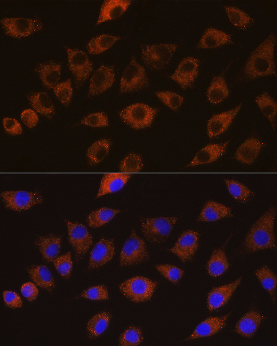 SAP97 Antibody in Immunocytochemistry (ICC/IF)