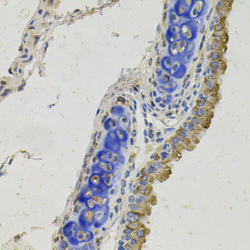 GAS6 Antibody in Immunohistochemistry (Paraffin) (IHC (P))