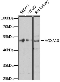 HOXA10 Antibody in Western Blot (WB)