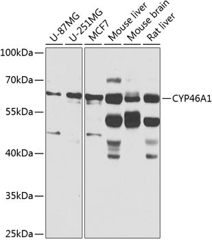 CYP46A1 Antibody in Western Blot (WB)