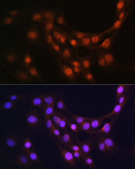 GMFB Antibody in Immunocytochemistry (ICC/IF)