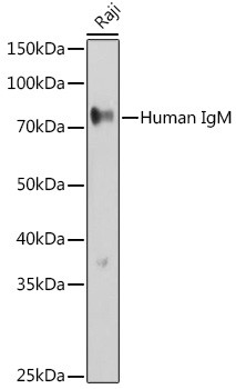 Human IgM Antibody in Western Blot (WB)