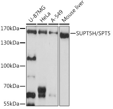 SPT5 Antibody in Western Blot (WB)