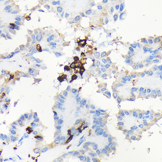 Coronin 1A Antibody in Immunohistochemistry (Paraffin) (IHC (P))