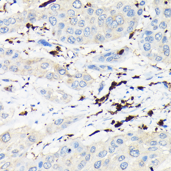 Coronin 1A Antibody in Immunohistochemistry (Paraffin) (IHC (P))