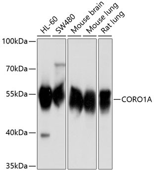 Coronin 1A Antibody in Western Blot (WB)
