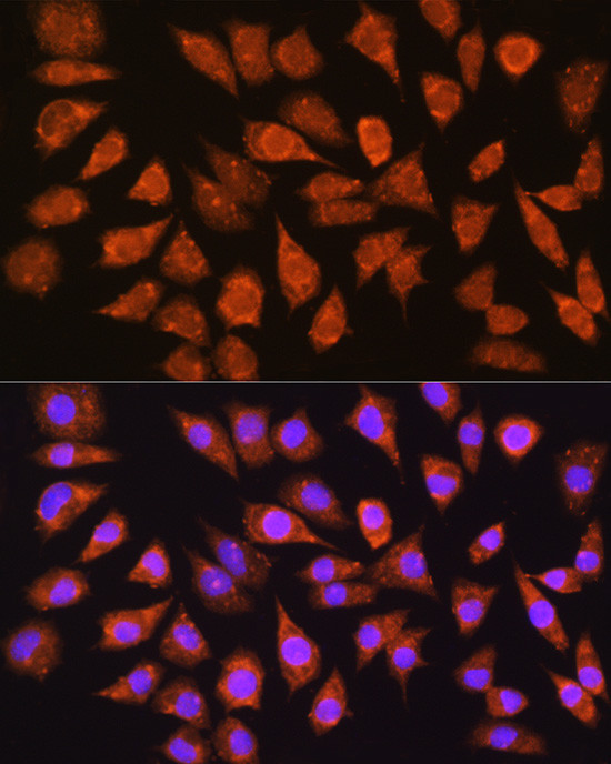 IMPDH1 Antibody in Immunocytochemistry (ICC/IF)