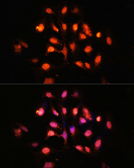 PHLPP1 Antibody in Immunocytochemistry (ICC/IF)