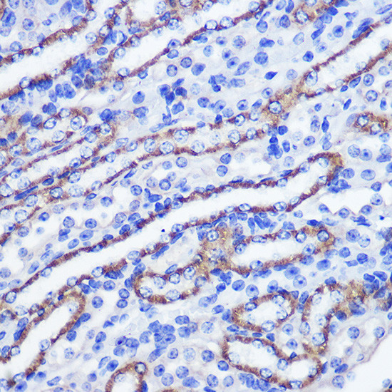 PHLPP1 Antibody in Immunohistochemistry (Paraffin) (IHC (P))