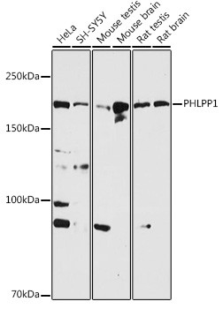 PHLPP1 Antibody in Western Blot (WB)