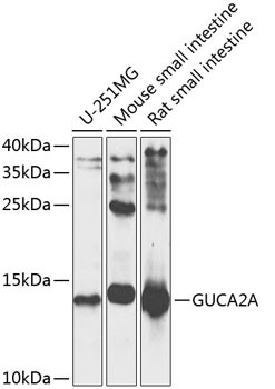 GUCA2A Antibody in Western Blot (WB)