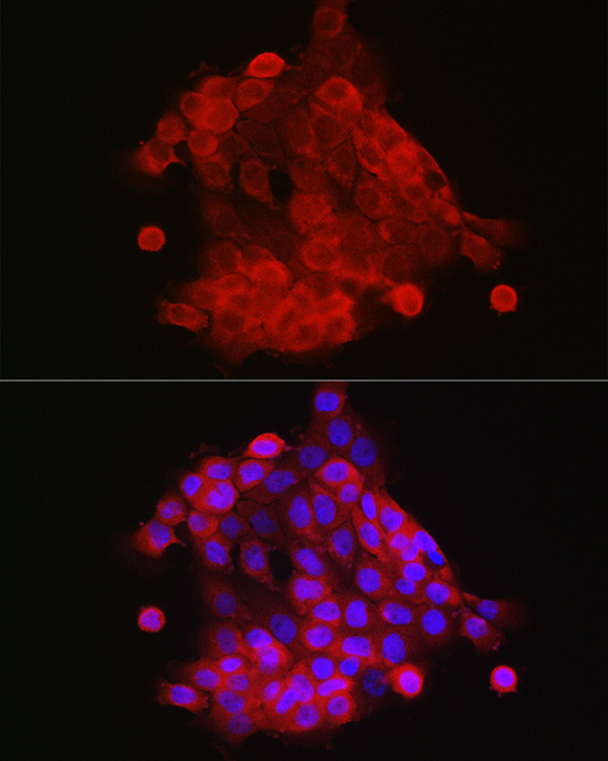 S100A9 Antibody in Immunocytochemistry (ICC/IF)