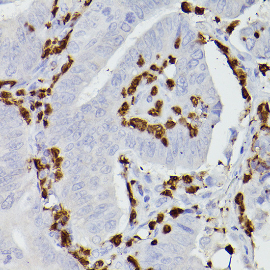 S100A9 Antibody in Immunohistochemistry (Paraffin) (IHC (P))