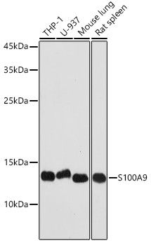 S100A9 Antibody in Western Blot (WB)