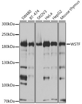 BAZ1B Antibody in Western Blot (WB)